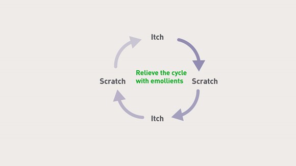 Epaderm can help break the itch cycle