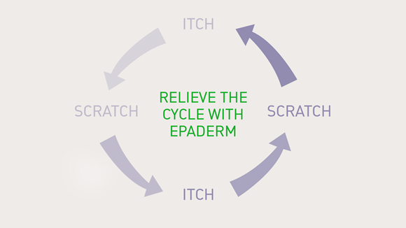 Help to break the itch cycle with Epaderm